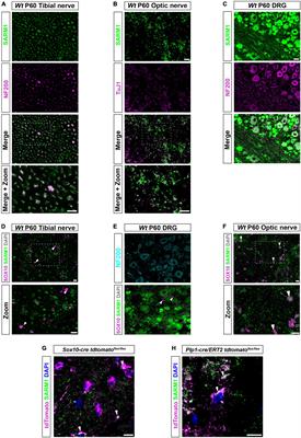 SARM1 detection in myelinating glia: sarm1/Sarm1 is dispensable for PNS and CNS myelination in zebrafish and mice